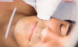 procedimentos masculinos, estetica masculina, botox masculino, preenchimento de queixo